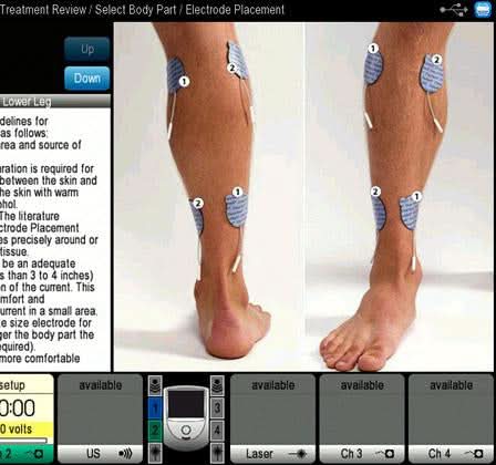 Chattanooga Intelect NEO Therapy System - Image 6