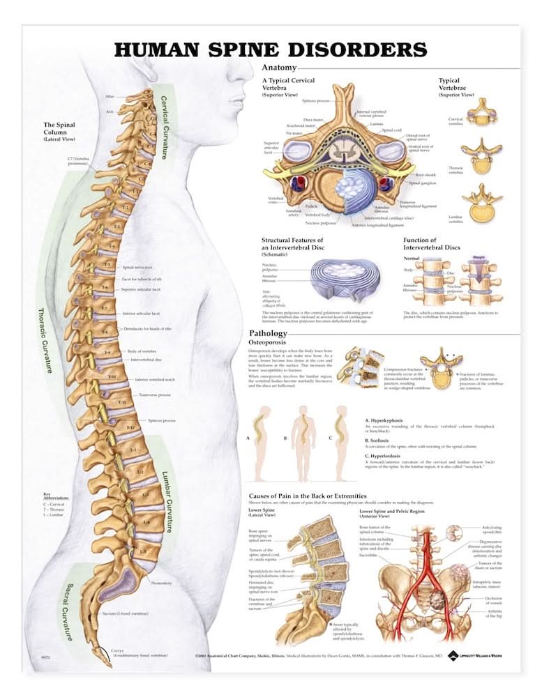 Human Spine Disorders Chart